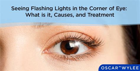flashes in eye.